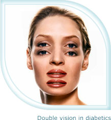 Double vision in diabetics